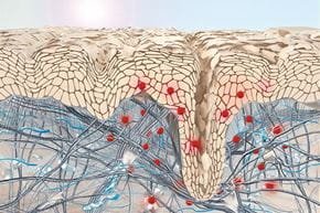 ozonoterapia para mejorar la piel