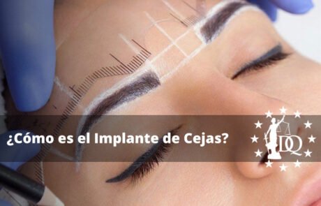 ¿Cómo es el Implante de Cejas?