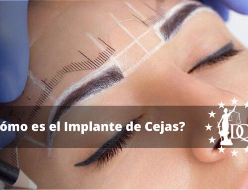 ¿Cómo es el Implante de Cejas?