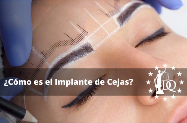 ¿Cómo es el Implante de Cejas?