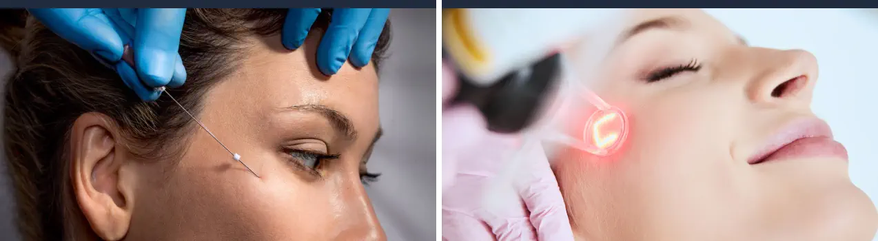 Máster Estética Facial Online - Tratamientos Faciales