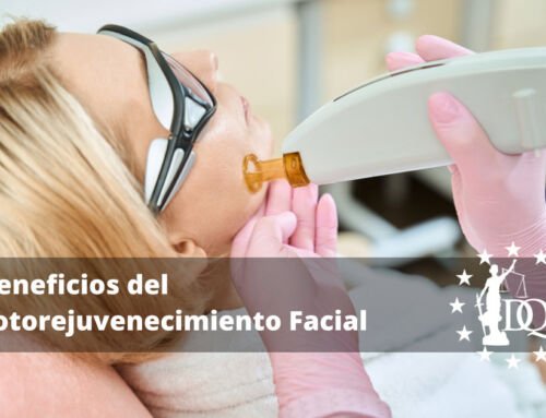 Beneficios del Fotorejuvenecimiento Facial y Opiniones